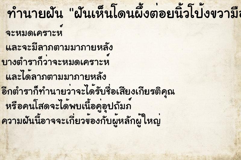 ทำนายฝันฝันเห็นโดนผึ้งต่อยนิ้วโป้งขวามือ ทำนายฝันทำนายฝันฝันเห็นโดนผึ้งต่อยนิ้วโป้งขวามือ