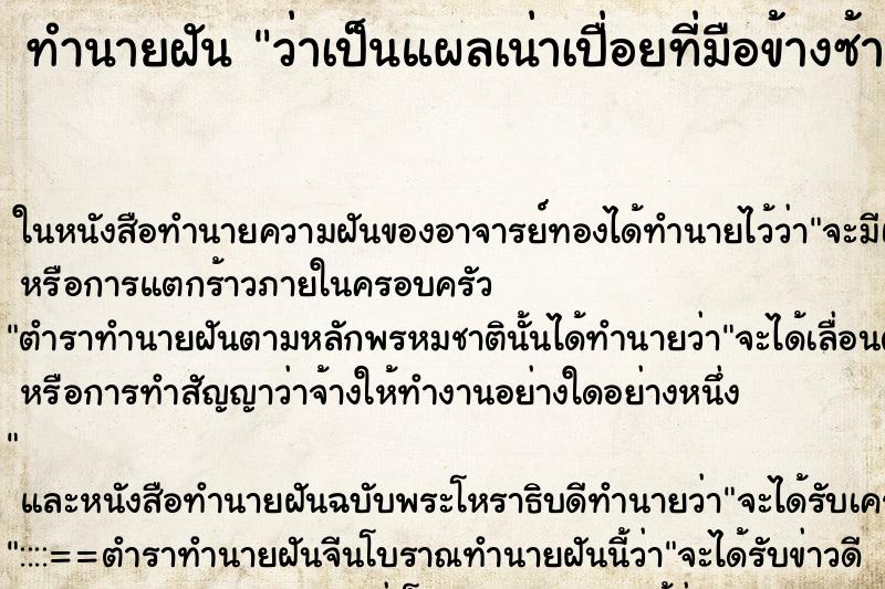 ทำนายฝัน ว่าเป็นแผลเน่าเปื่อยที่มือข้างซ้าย ทำนายฝัน ว่าเป็นแผลเน่าเปื่อยที่มือข้างซ้าย