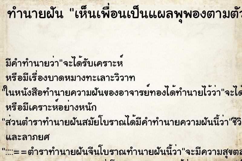 ทำนายฝันทำนายฝันเห็นเพื่อนเป็นแผลพุพองตามตัว