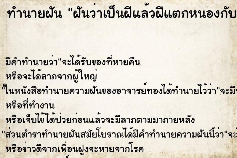 ทำนายฝัน ฝันว่าเป็นฝีแล้วฝีแตกหนองกับเลือดออก ทำนายฝัน ฝันว่าเป็นฝีแล้วฝีแตกหนองกับเลือดออก
