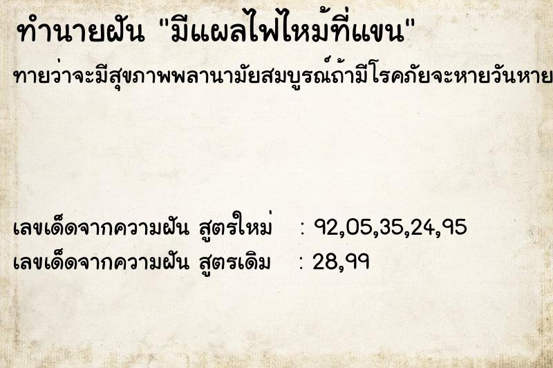 ทำนายฝันมีแผลไฟไหม้ที่แขน ทำนายฝันทำนายฝันมีแผลไฟไหม้ที่แขน
