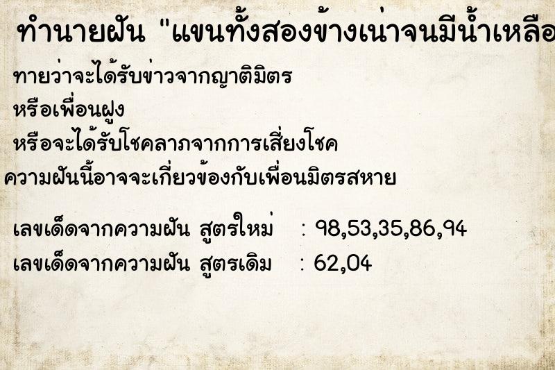 ทำนายฝันแขนทั้งสองข้างเน่าจนมีน้ำเหลือง ทำนายฝันทำนายฝันแขนทั้งสองข้างเน่าจนมีน้ำเหลือง