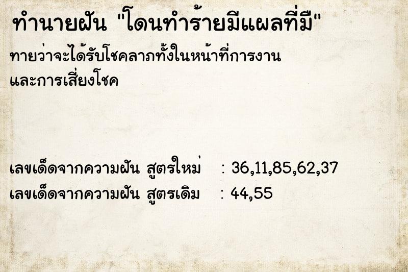 ทำนายฝันทำนายฝันโดนทำร้ายมีแผลที่มื