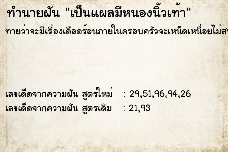 ทำนายฝันทำนายฝันเป็นแผลมีหนองนิ้วเท้า