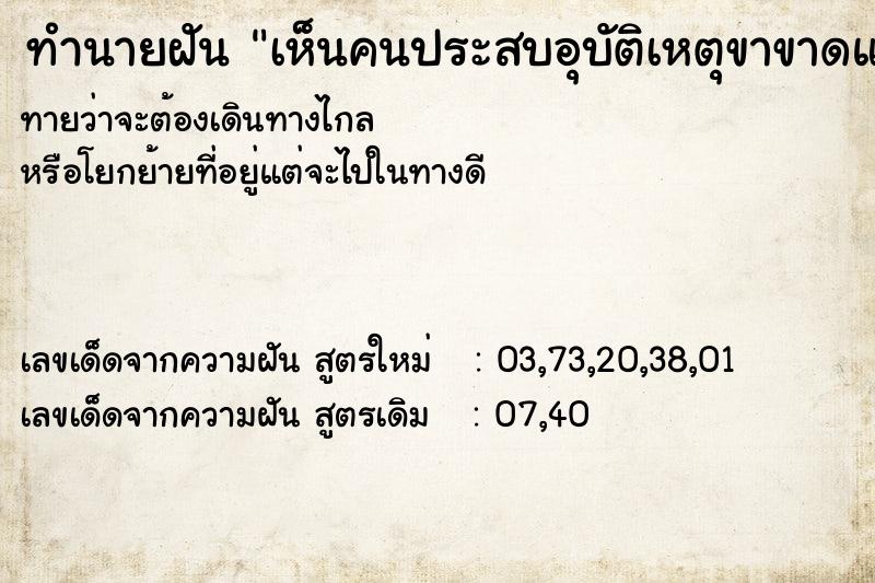 ทำนายฝันทำนายฝันเห็นคนประสบอุบัติเหตุขาขาดแขนขาด