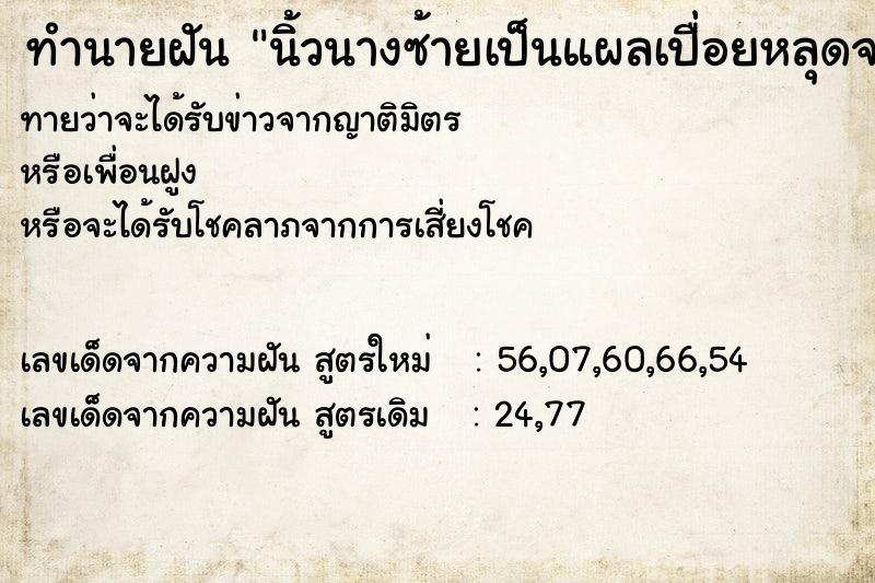 ทำนายฝันนิ้วนางซ้ายเป็นแผลเปื่อยหลุดจากมือ ทำนายฝันทำนายฝันนิ้วนางซ้ายเป็นแผลเปื่อยหลุดจากมือ