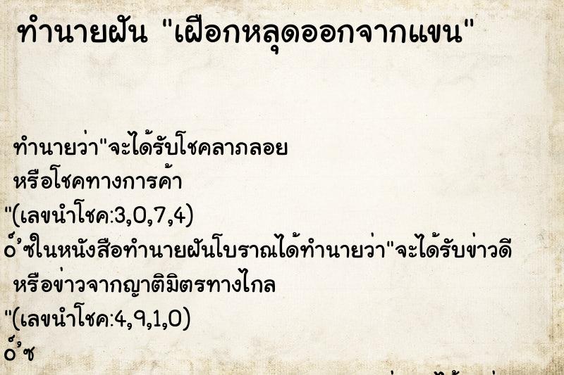 ทำนายฝัน เฝือกหลุดออกจากแขน ทำนายฝัน เฝือกหลุดออกจากแขน