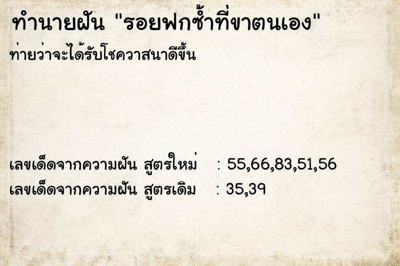 ทำนายฝันรอยฟกซ้ำที่ขาตนเอง ทำนายฝันทำนายฝันรอยฟกซ้ำที่ขาตนเอง