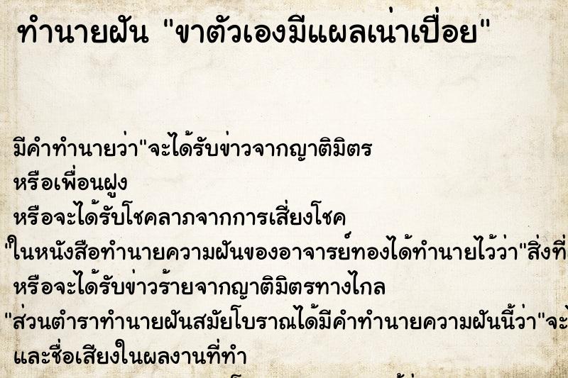 ทำนายฝัน ขาตัวเองมีแผลเน่าเปื่อย ทำนายฝัน ขาตัวเองมีแผลเน่าเปื่อย