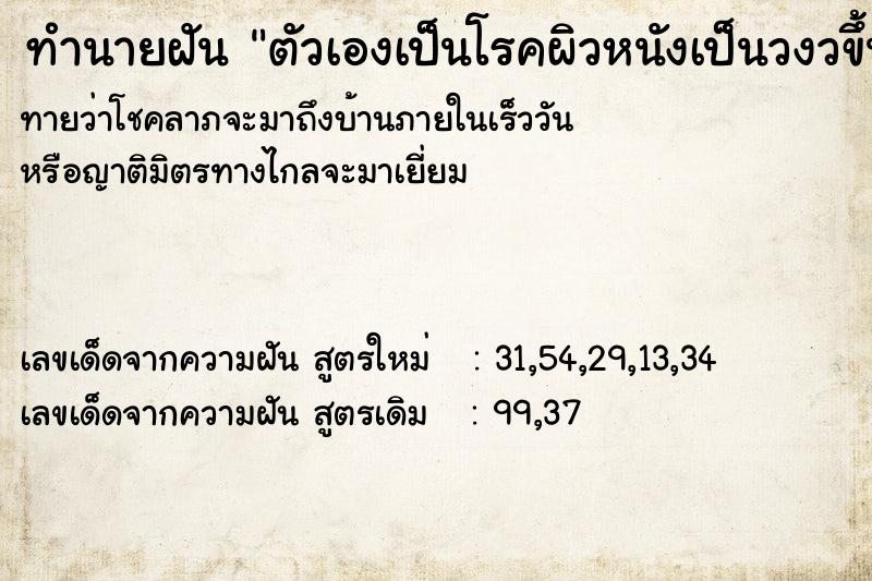 ทำนายฝันทำนายฝันตัวเองเป็นโรคผิวหนังเป็นวงวขึ้นตามตัว