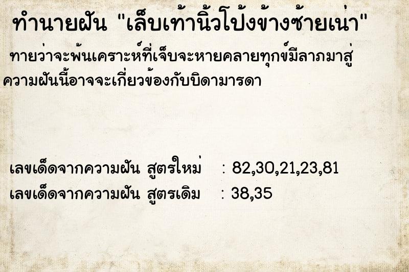 ทำนายฝันเล็บเท้านิ้วโป้งข้างซ้ายเน่า ทำนายฝันทำนายฝันเล็บเท้านิ้วโป้งข้างซ้ายเน่า