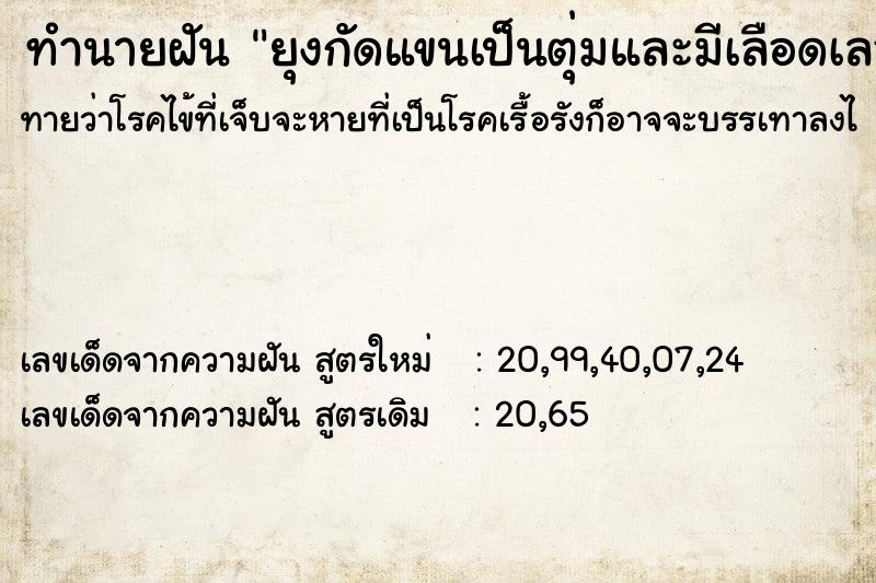 ทำนายฝันยุงกัดแขนเป็นตุ่มและมีเลือดเลอะแขนกับมือ ทำนายฝันทำนายฝันยุงกัดแขนเป็นตุ่มและมีเลือดเลอะแขนกับมือ