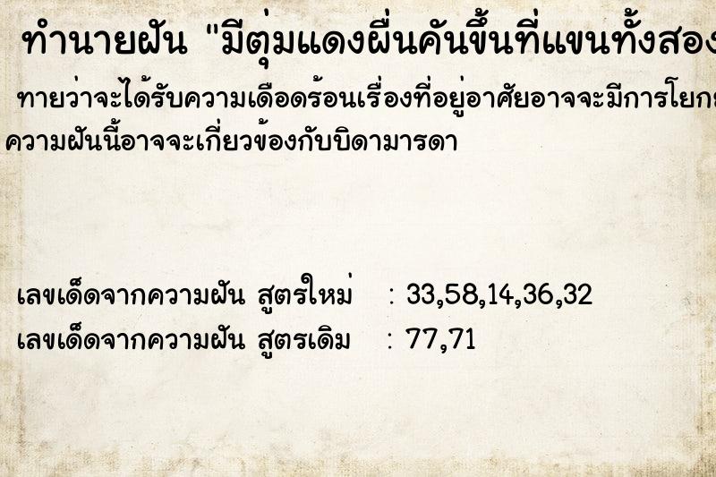 ทำนายฝันทำนายฝันมีตุ่มแดงผื่นคันขึ้นที่แขนทั้งสองข้าง