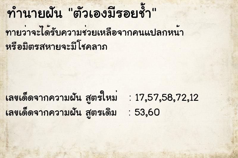 ทำนายฝัน ตัวเองมีรอยช้ำ ทำนายฝัน ตัวเองมีรอยช้ำ