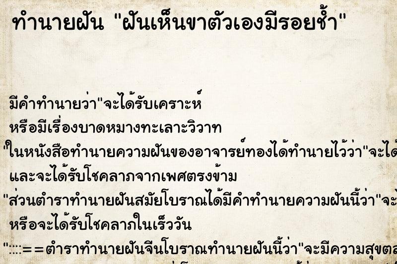 ทำนายฝัน ฝันเห็นขาตัวเองมีรอยช้ำ ทำนายฝัน ฝันเห็นขาตัวเองมีรอยช้ำ