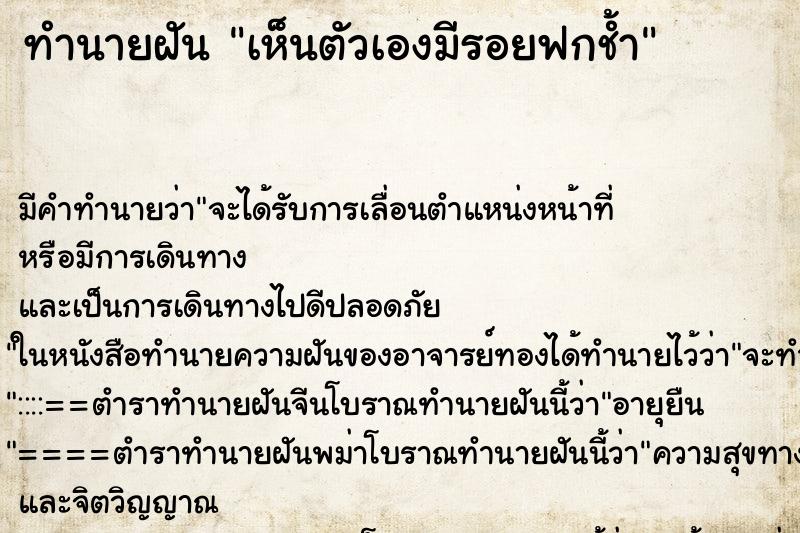 ทำนายฝัน เห็นตัวเองมีรอยฟกช้ำ ทำนายฝัน เห็นตัวเองมีรอยฟกช้ำ