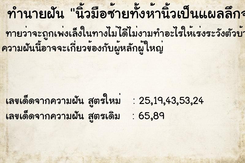 ทำนายฝันทำนายฝันนิ้วมือซ้ายทั้งห้านิ้วเป็นแผลลึกจนเห็นกระดูก