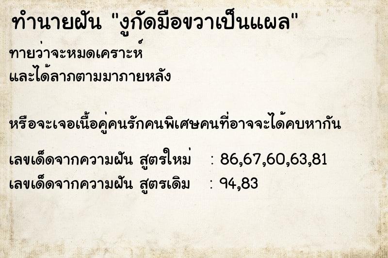 ทำนายฝันทำนายฝันงูกัดมือขวาเป็นแผล