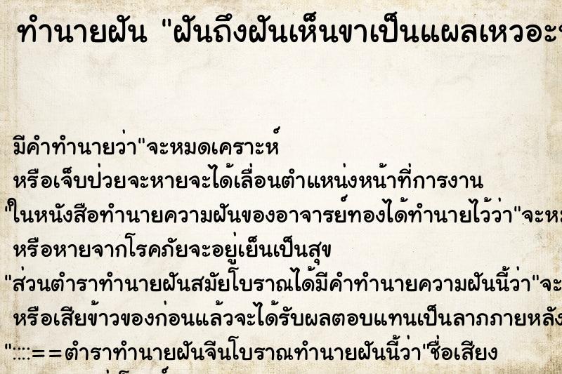 ทำนายฝัน ฝันถึงฝันเห็นขาเป็นแผลเหวอะหวะใหญ่มากจนเห็นกระดูก ทำนายฝัน ฝันถึงฝันเห็นขาเป็นแผลเหวอะหวะใหญ่มากจนเห็นกระดูก