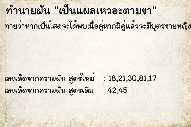 ทำนายฝันเป็นแผลเหวอะตามขา ทำนายฝันทำนายฝันเป็นแผลเหวอะตามขา