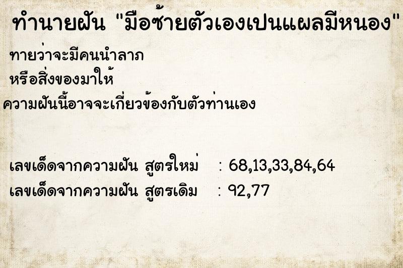 ทำนายฝันมือซ้ายตัวเองเปนแผลมีหนอง ทำนายฝันทำนายฝันมือซ้ายตัวเองเปนแผลมีหนอง