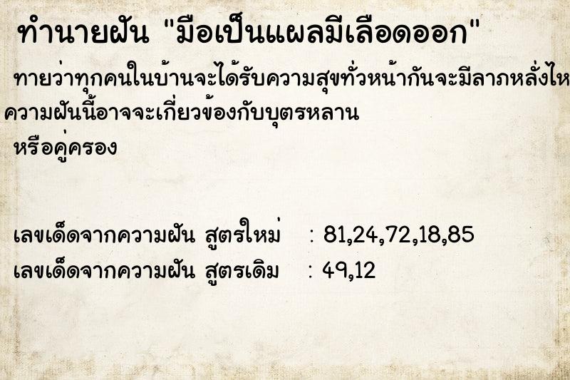 ทำนายฝันทำนายฝันมือเป็นแผลมีเลือดออก