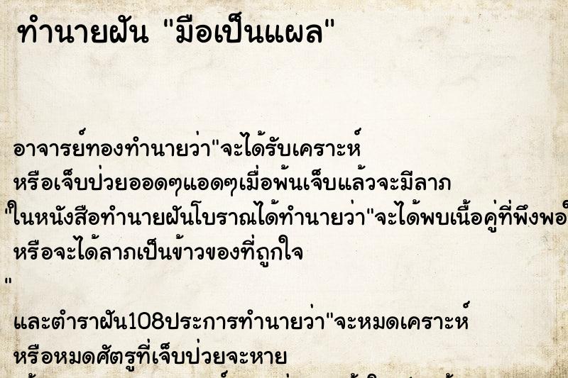 ทำนายฝัน มือเป็นแผล ทำนายฝัน มือเป็นแผล