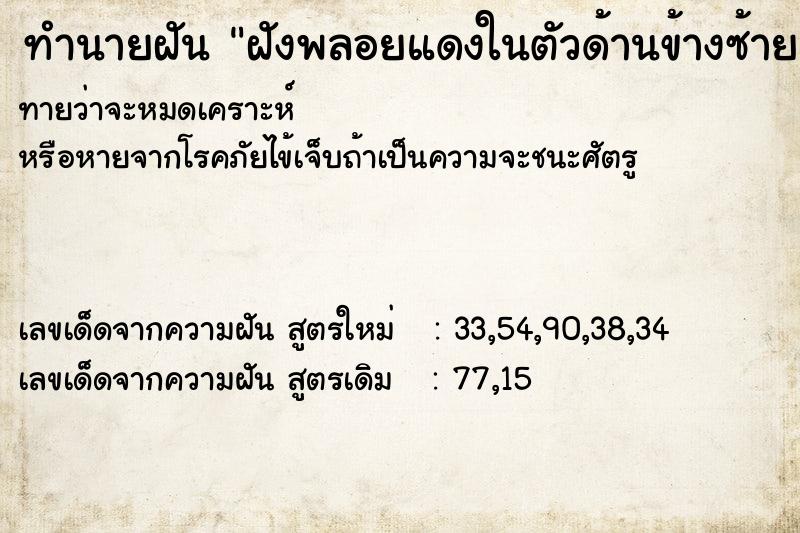 ทำนายฝันฝังพลอยแดงในตัวด้านข้างซ้าย ทำนายฝันทำนายฝันฝังพลอยแดงในตัวด้านข้างซ้าย