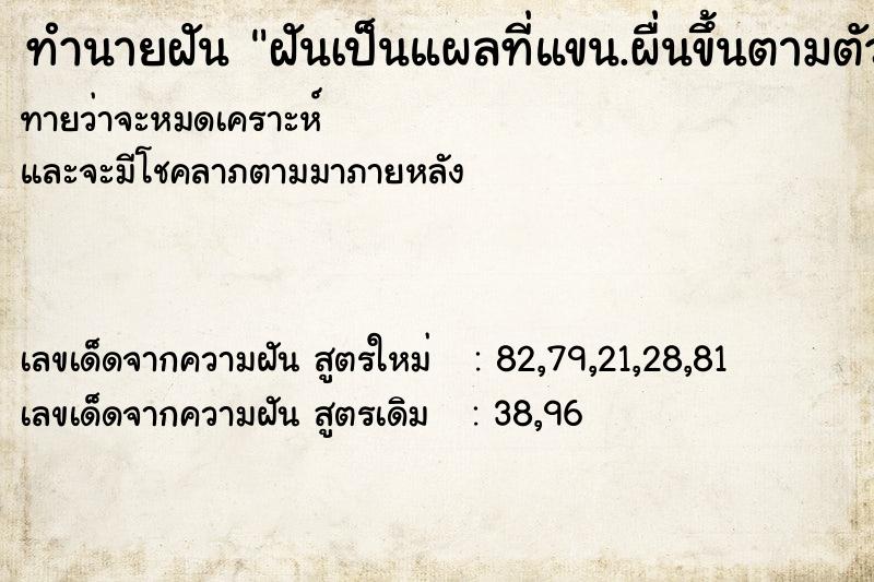 ทำนายฝันทำนายฝันฝันเป็นแผลที่แขน.ผื่นขึ้นตามตัว