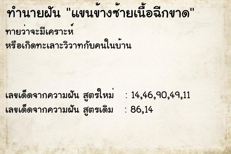ทำนายฝัน แขนข้างซ้ายเนื้อฉีกขาด ทำนายฝัน แขนข้างซ้ายเนื้อฉีกขาด