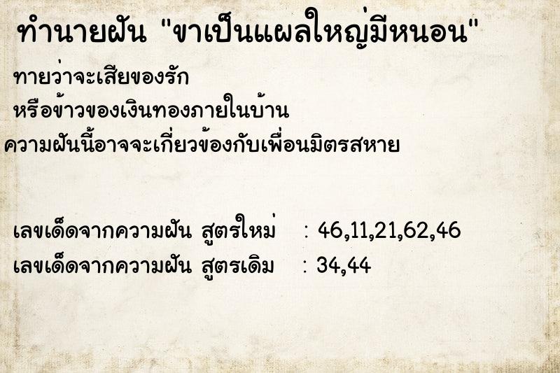 ทำนายฝันขาเป็นแผลใหญ่มีหนอน ทำนายฝันทำนายฝันขาเป็นแผลใหญ่มีหนอน