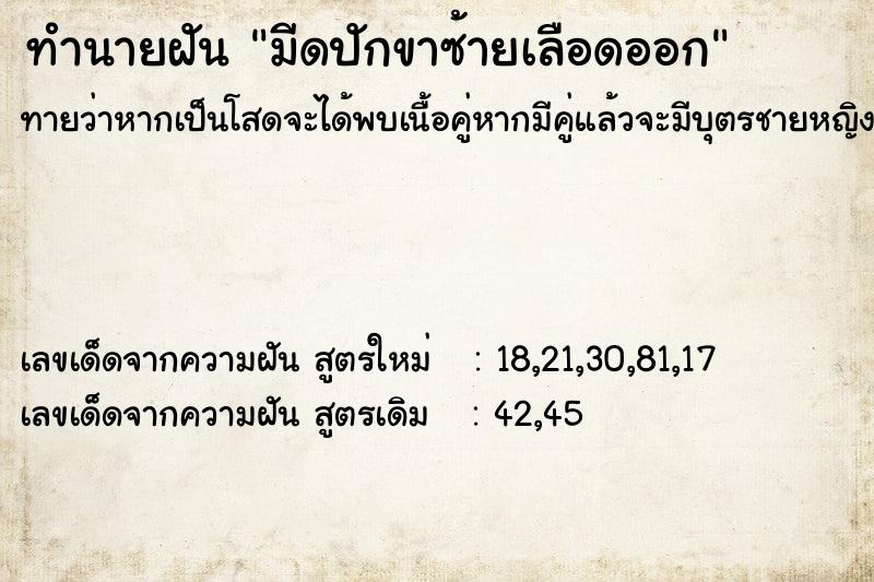 ทำนายฝันทำนายฝันมีดปักขาซ้ายเลือดออก