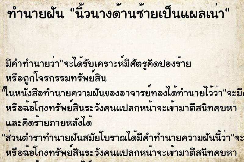 ทำนายฝัน นิ้วนางด้านซ้ายเป็นแผลเน่า ทำนายฝัน นิ้วนางด้านซ้ายเป็นแผลเน่า