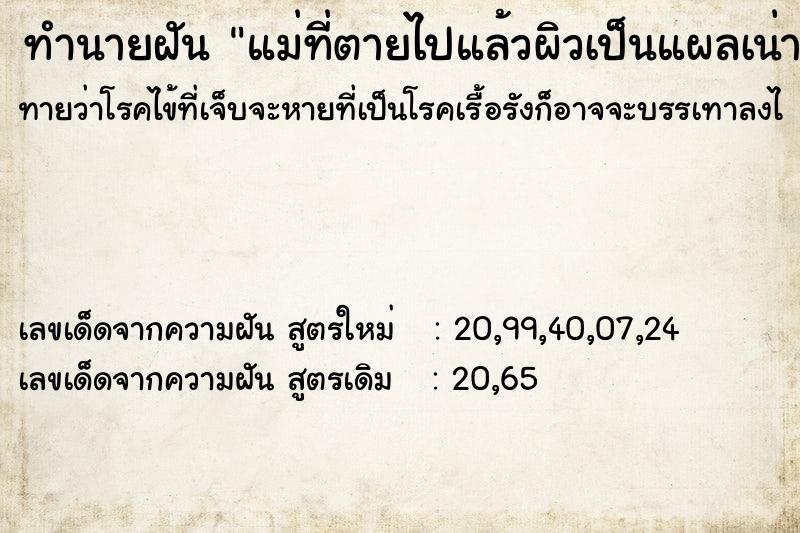 ทำนายฝันแม่ที่ตายไปแล้วผิวเป็นแผลเน่าเปือย ทำนายฝันทำนายฝันแม่ที่ตายไปแล้วผิวเป็นแผลเน่าเปือย