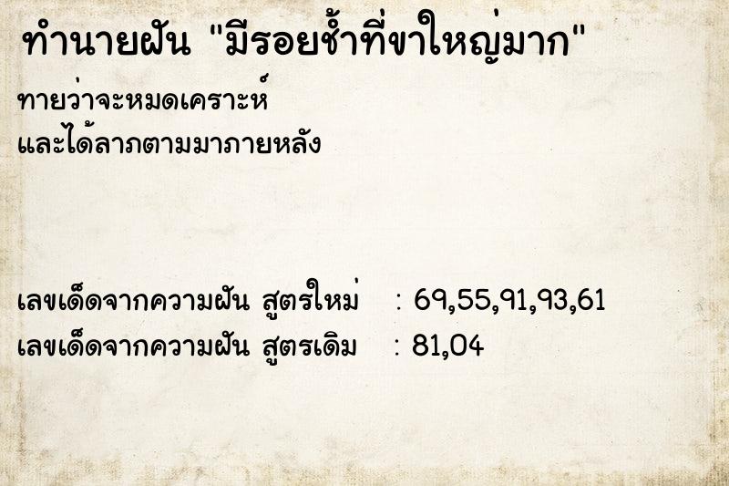 ทำนายฝันมีรอยช้ำที่ขาใหญ่มาก ทำนายฝันทำนายฝันมีรอยช้ำที่ขาใหญ่มาก