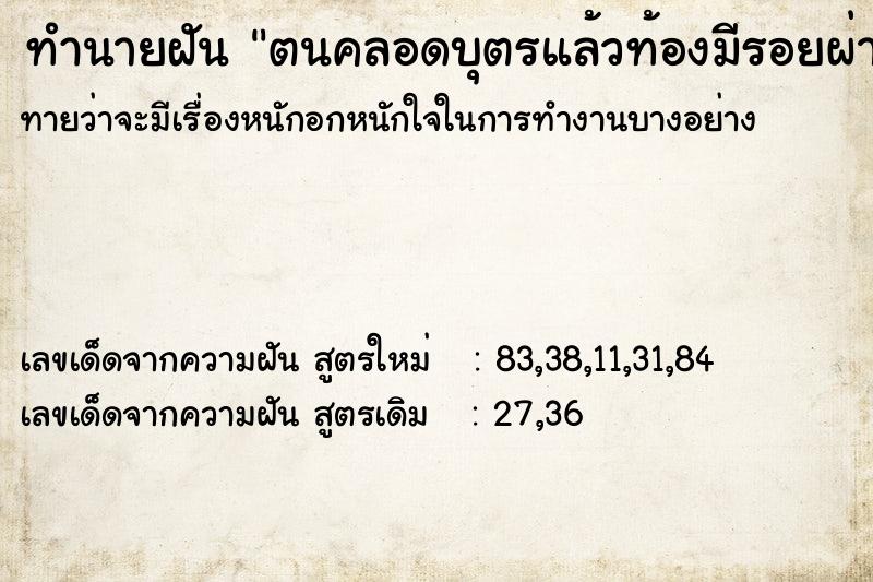 ทำนายฝันตนคลอดบุตรแล้วท้องมีรอยผ่า ทำนายฝันทำนายฝันตนคลอดบุตรแล้วท้องมีรอยผ่า