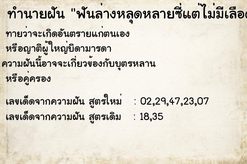ทำนายฝันฟันล่างหลุดหลายซี่แต่ไม่มีเลือดออก ทำนายฝันทำนายฝันฟันล่างหลุดหลายซี่แต่ไม่มีเลือดออก