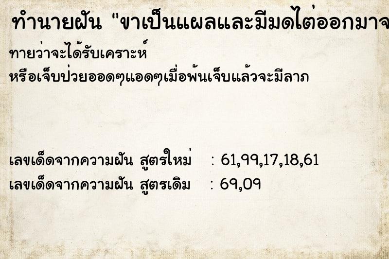 ทำนายฝันขาเป็นแผลและมีมดไต่ออกมาจากขาที่เป็นแผล ทำนายฝันทำนายฝันขาเป็นแผลและมีมดไต่ออกมาจากขาที่เป็นแผล
