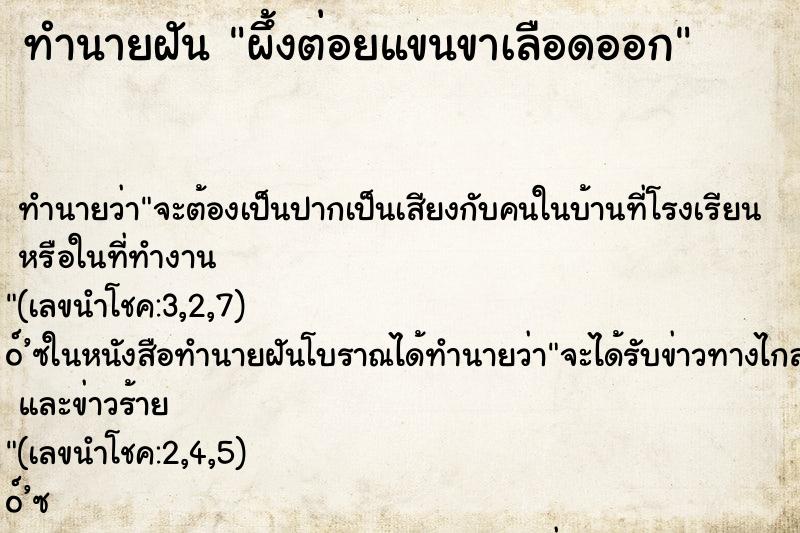 ทำนายฝันผึ้งต่อยแขนขาเลือดออก ทำนายฝันทำนายฝันผึ้งต่อยแขนขาเลือดออก