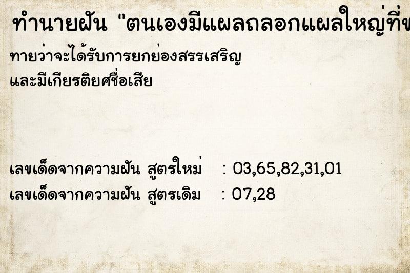 ทำนายฝันทำนายฝันตนเองมีแผลถลอกแผลใหญ่ที่ขา