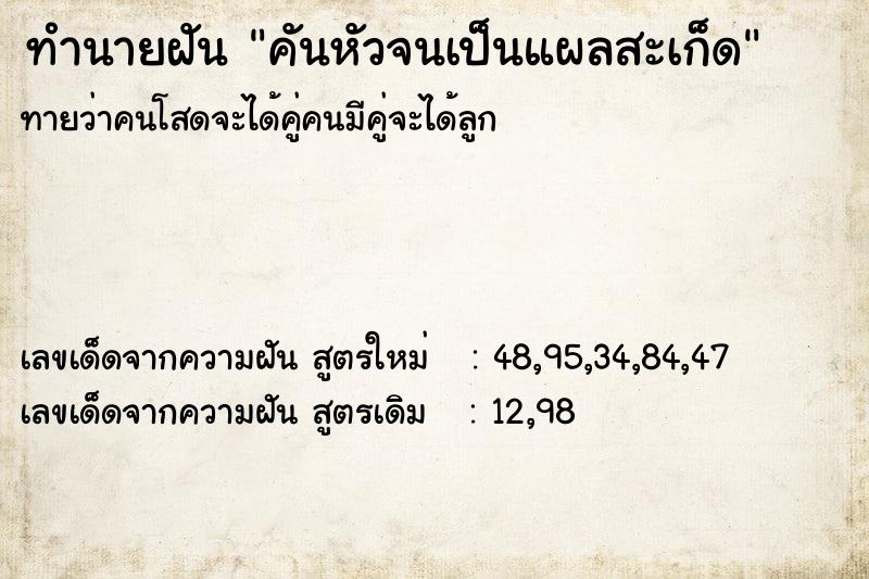 ทำนายฝันคันหัวจนเป็นแผลสะเก็ด ทำนายฝันทำนายฝันคันหัวจนเป็นแผลสะเก็ด