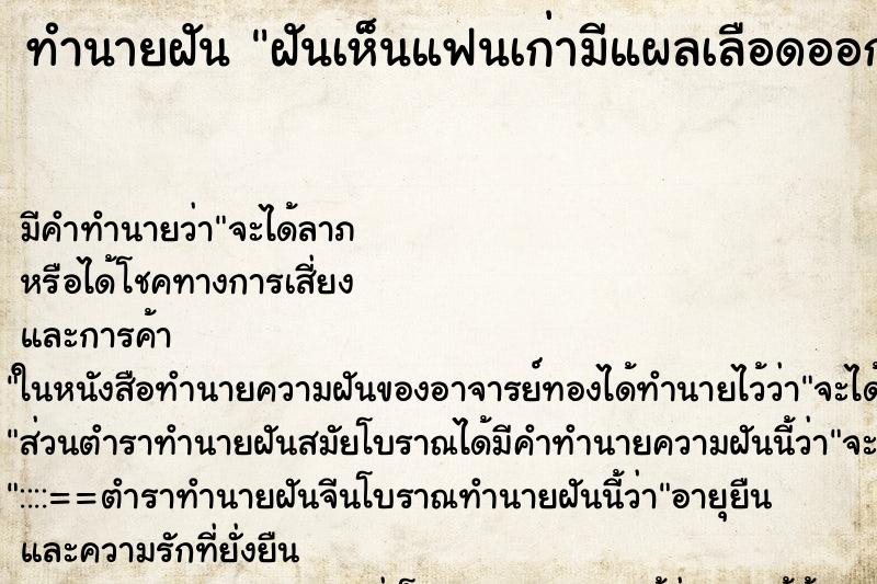ทำนายฝัน ฝันเห็นแฟนเก่ามีแผลเลือดออกเต็มตัว ทำนายฝัน ฝันเห็นแฟนเก่ามีแผลเลือดออกเต็มตัว