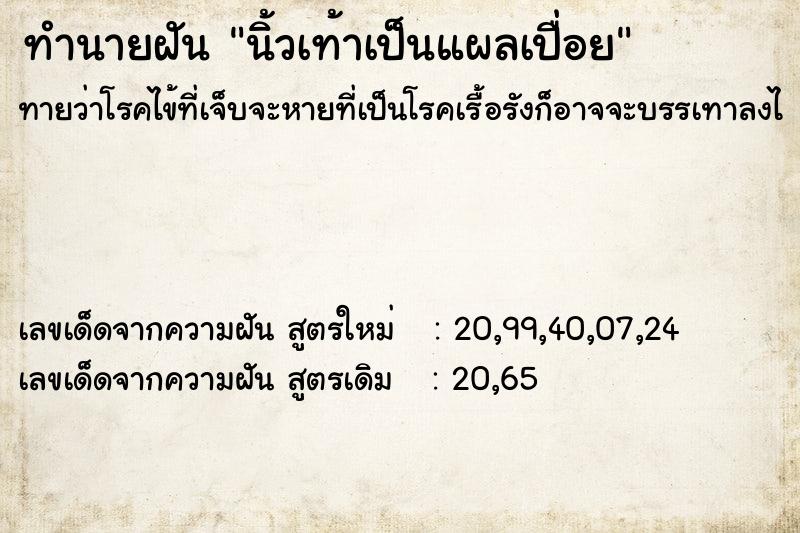 ทำนายฝันนิ้วเท้าเป็นแผลเปื่อย ทำนายฝันทำนายฝันนิ้วเท้าเป็นแผลเปื่อย