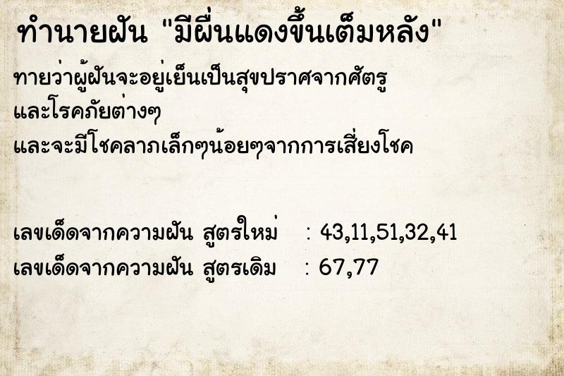 ทำนายฝันทำนายฝันมีผื่นแดงขึ้นเต็มหลัง