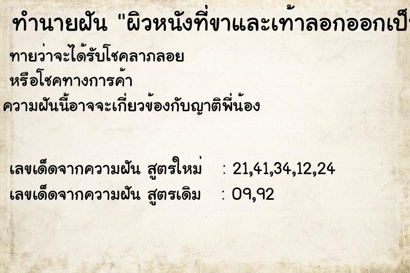 ทำนายฝันผิวหนังที่ขาและเท้าลอกออกเป็นแผ่น ทำนายฝันทำนายฝันผิวหนังที่ขาและเท้าลอกออกเป็นแผ่น