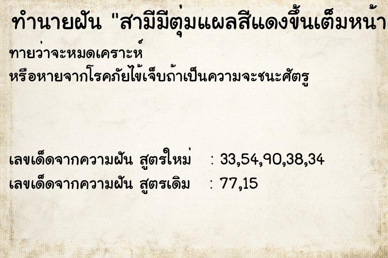 ทำนายฝันทำนายฝันสามีมีตุ่มแผลสีแดงขึ้นเต็มหน้าเต็มตัววัน