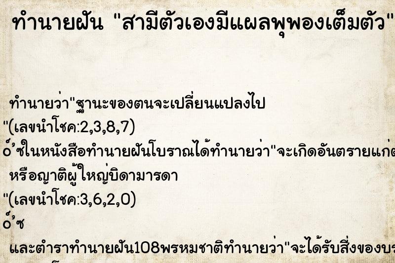 ทำนายฝัน สามีตัวเองมีแผลพุพองเต็มตัว ทำนายฝัน สามีตัวเองมีแผลพุพองเต็มตัว
