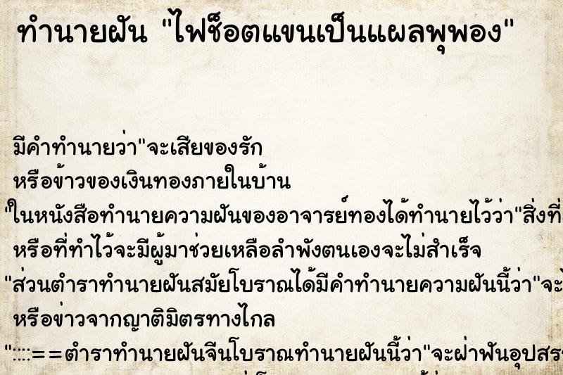 ทำนายฝัน ไฟช็อตแขนเป็นแผลพุพอง ทำนายฝัน ไฟช็อตแขนเป็นแผลพุพอง