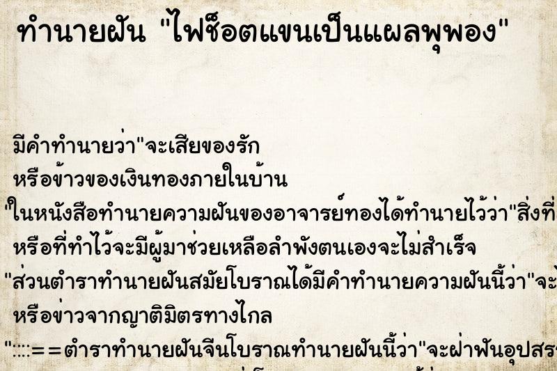 ทำนายฝัน ไฟช็อตแขนเป็นแผลพุพอง ตำราโบราณ แม่นที่สุดในโลก