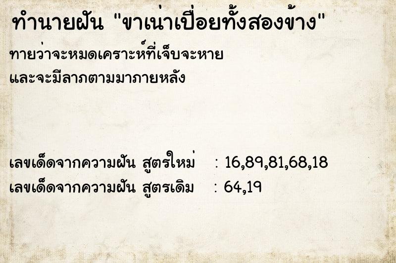 ทำนายฝันขาเน่าเปื่อยทั้งสองข้าง ทำนายฝันทำนายฝันขาเน่าเปื่อยทั้งสองข้าง